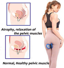 Load image into Gallery viewer, The Ultimate Pelvic Floor Trainer - VirginiaCare